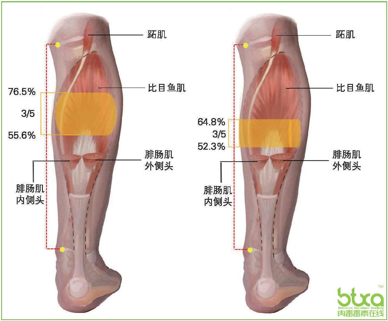 小腿三頭肌